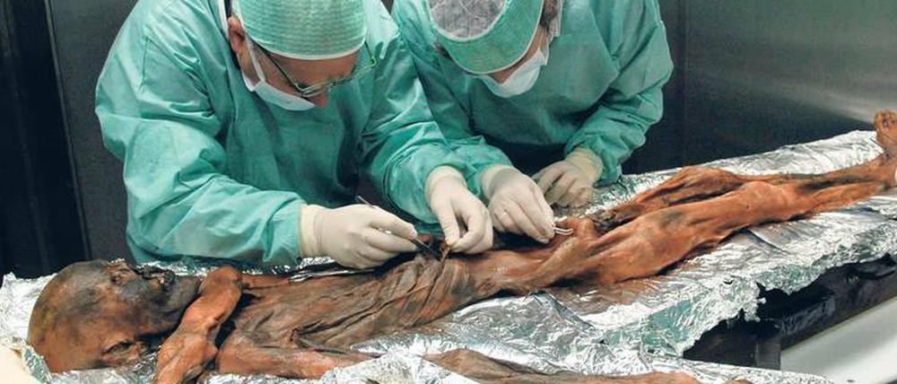 Voll Fett. Wissenschaftler entnehmen Proben aus dem Magen der Steinzeit-Gletschermumie Ötzi.