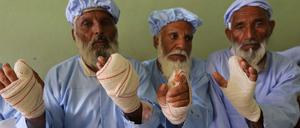 Wahl und Gewalt: Weil sie zur Wahl gegangen waren, schnitten Taliban diesen Männern die mit Tinte gekennzeichneten Finger ab.