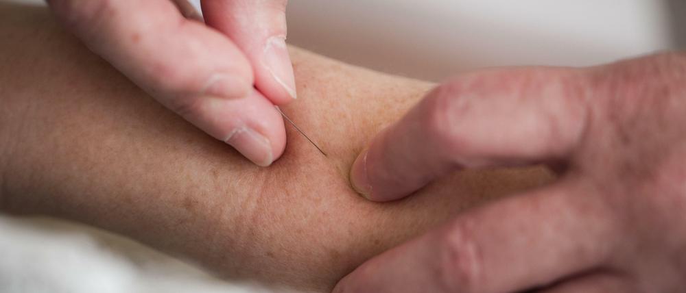 Bei der Akupunktur werden Nadeln an bestimmte Punkte des Körpers gestochen. Ob das hilft, ist umstritten.