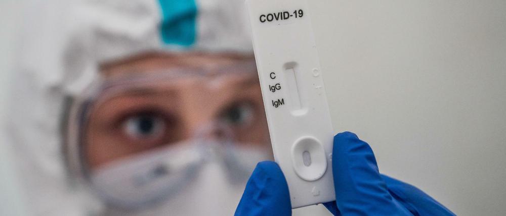 Ein Mediziner prüft einen IgG-/IgM-Schnelltest zum COVID-19-Antikörper-Nachweis.