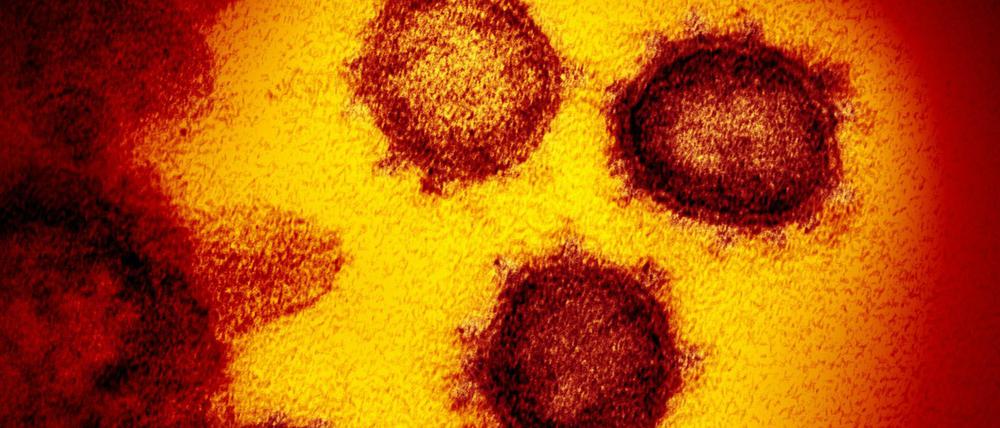 Die vom National Institute of Allergy and Infectious Diseases zur Verfügung gestellte Elektronenmikroskopaufnahme zeigt das Coronavirus SARS-CoV-2.