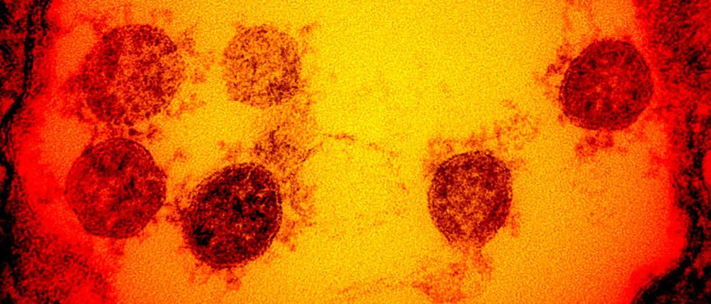 Der Antikörper von Eli Lilly "verklebt" die "Stachel", mit denen Sars-CoV-2-Viren (die kreisförmigen Gebilde in der elektronenmikroskopischen Aufnahme) in die Zellen eindringen.